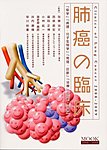 肺癌の臨床