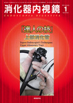 消化器内視鏡