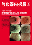 消化器内視鏡