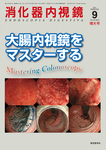 消化器内視鏡
