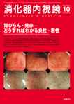 消化器内視鏡