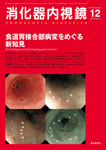 消化器内視鏡