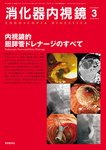 消化器内視鏡