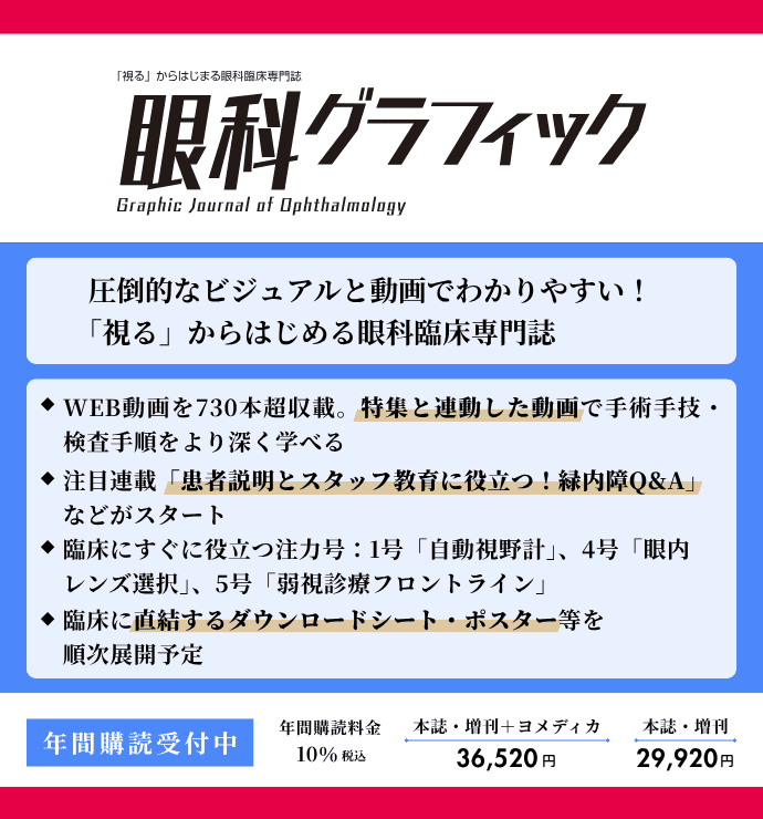 眼科グラフィックの詳細
