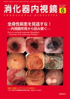 胆と膵 Vol.37 特大号 (発売日2016年10月31日) | 雑誌/定期購読の予約 