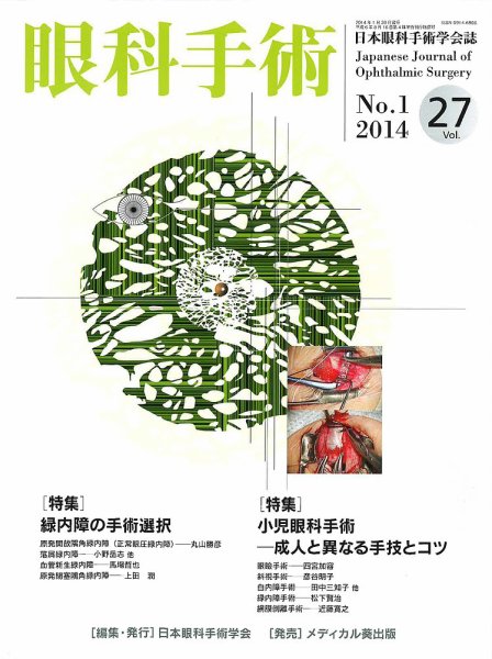 眼科手術 Vol.27 No.1 (発売日2014年01月30日) 表紙