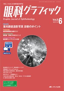 眼科グラフィック 2013年6号 (発売日2013年11月15日) 表紙