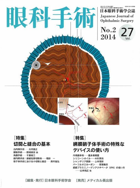 眼科手術 Vol.27 No.2 (発売日2014年04月30日) 表紙