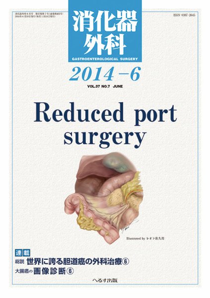 消化器外科 2014年6月号 (発売日2014年06月12日) 表紙