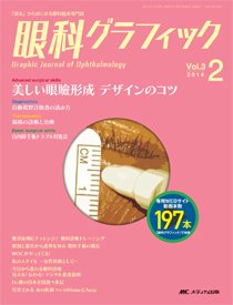 眼科グラフィック 2014年2号 (発売日2014年03月15日) 表紙