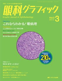 眼科グラフィック 2014年3号 (発売日2014年05月15日) 表紙