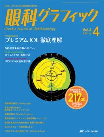 眼科グラフィック 2014年4号 (発売日2014年07月15日) 表紙
