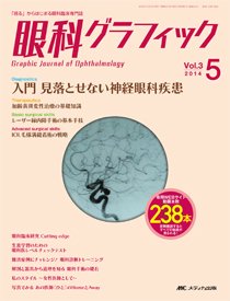 眼科グラフィック 2014年5号 (発売日2014年09月15日) 表紙