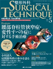 整形外科サージカルテクニック 2014年5号 (発売日2014年09月15日) 表紙