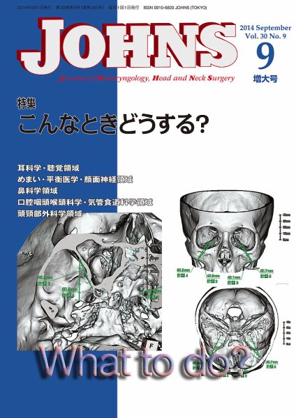 JOHNS（ジョウンズ） 14年9月増大号 (発売日2014年09月01日) 表紙