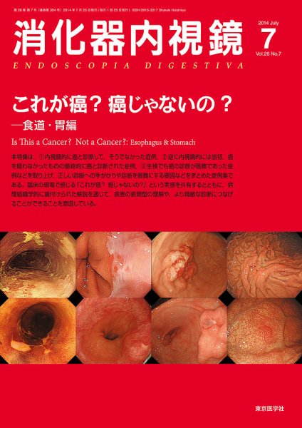 消化器内視鏡 14年7月号 (発売日2014年07月25日) 表紙
