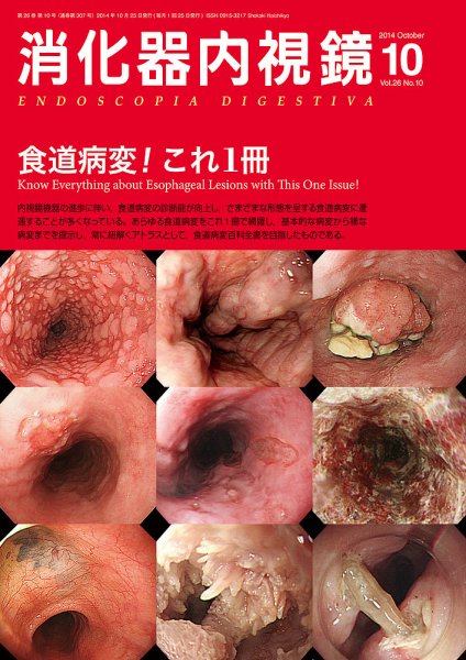 消化器内視鏡 14年10月号 (発売日2014年10月25日) | 雑誌/定期購読の