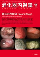消化器内視鏡 14年11月号 (発売日2014年11月25日) 表紙