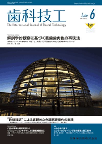 歯科技工 Vol.42 No.6 (発売日2014年05月31日) 表紙