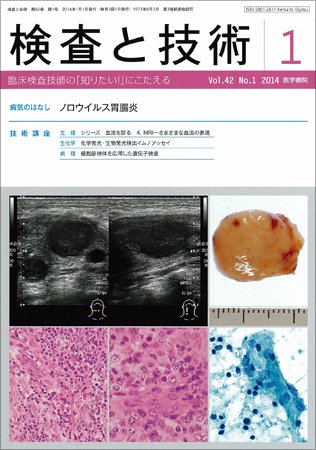 検査と技術 Vol.42 No.1 (発売日2014年01月10日) 表紙