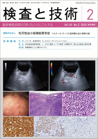 検査と技術 Vol.42 No.2 (発売日2014年02月01日) 表紙