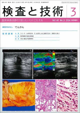 検査と技術 Vol.42 No.3 (発売日2014年03月01日) 表紙