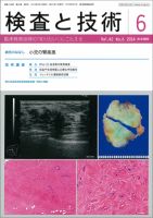 検査と技術 Vol.42 No.6 (発売日2014年06月01日) 表紙