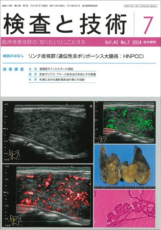 検査と技術 Vol.42 No.7 (発売日2014年07月01日) 表紙