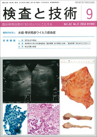 検査と技術 Vol.42 No.9 (発売日2014年09月01日) 表紙