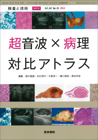 検査と技術 Vol.42 No.10 (発売日2014年09月15日) | 雑誌/定期