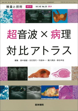 検査と技術 Vol.42 No.10 (発売日2014年09月15日) 表紙