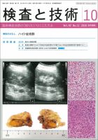 検査と技術 Vol.42 No.11 表紙