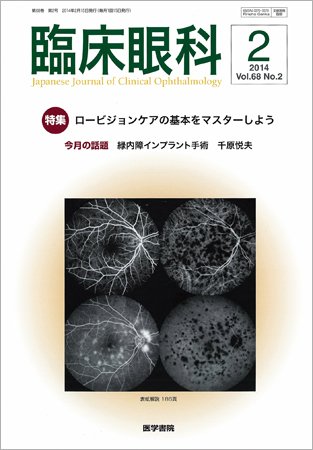 臨床眼科 Vol.68 No.2 (発売日2014年02月15日) 表紙