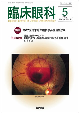 臨床眼科 Vol.68 No.5 (発売日2014年05月15日) 表紙