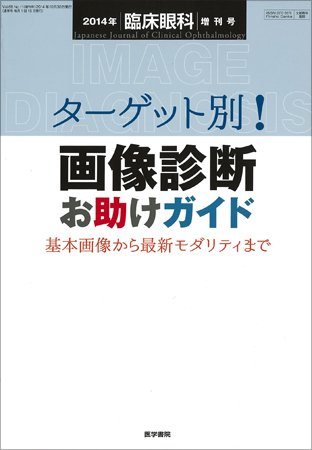 臨床眼科 Vol.68 No.11 (発売日2014年10月30日) 表紙