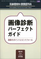耳鼻咽喉科・頭頸部外科 Vol.86 No.5 (発売日2014年04月30日) 表紙