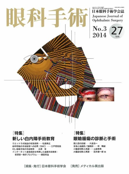 眼科手術 Vol.27 No.3 (発売日2014年07月30日) 表紙