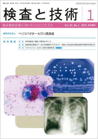 検査と技術 Vol.43 No.1 (発売日2015年01月01日) 表紙