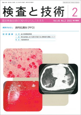 検査と技術 Vol.43 No.2 (発売日2015年02月01日) 表紙