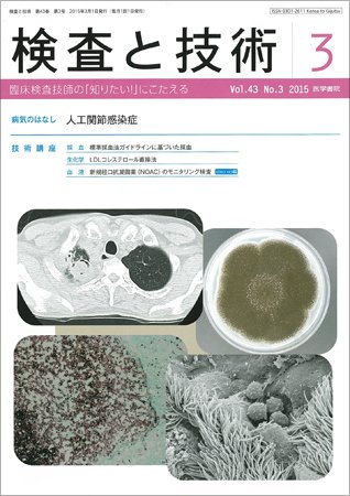 検査と技術 Vol.43 No.3 (発売日2015年03月01日) 表紙