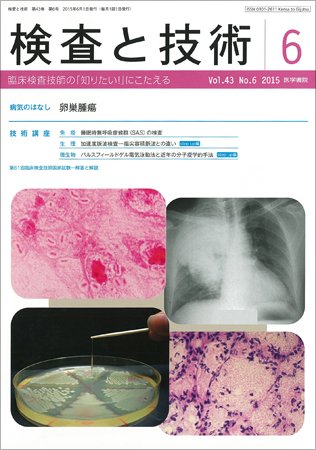 検査と技術 Vol.43 No.6 (発売日2015年06月01日) 表紙