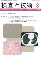 検査と技術 Vol.43 No.8 表紙