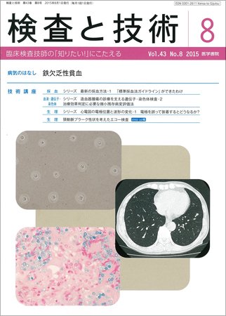 検査と技術 Vol.43 No.8 (発売日2015年08月01日) 表紙
