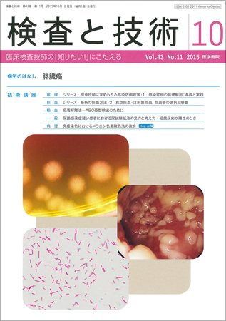 検査と技術 Vol.43 No.11 (発売日2015年10月01日) 表紙