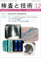 検査と技術 Vol.43 No.13 (発売日2015年12月01日) 表紙