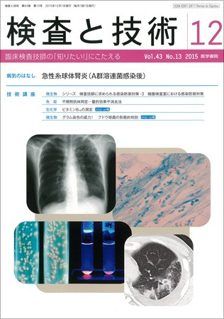 検査と技術 Vol.43 No.13 (発売日2015年12月01日) 表紙