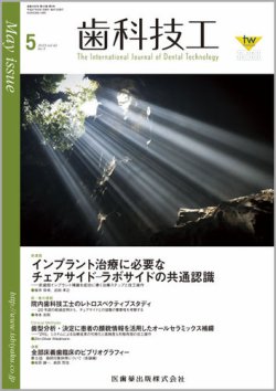 歯科技工 Vol.43 No.5 (発売日2015年04月30日) 表紙