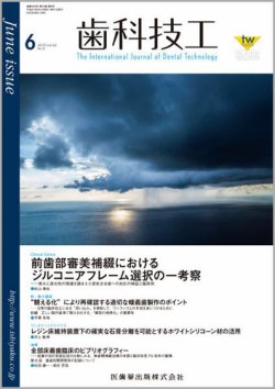歯科技工 Vol.43 No.6 (発売日2015年05月31日) 表紙