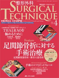 整形外科サージカルテクニック 2015年4号 (2015年07月15日発売) | Fujisan.co.jpの雑誌・定期購読