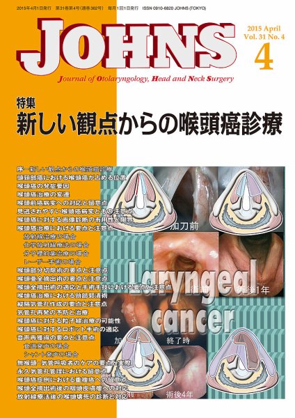 JOHNS（ジョウンズ） 15年4月号 (発売日2015年04月01日) 表紙